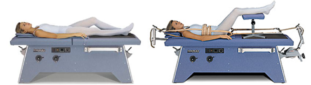 Spinal Compression Therapy